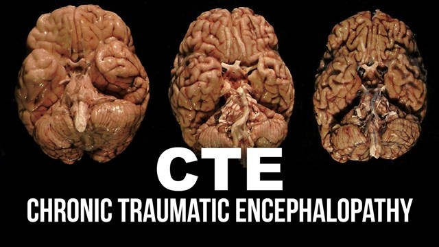 CTE